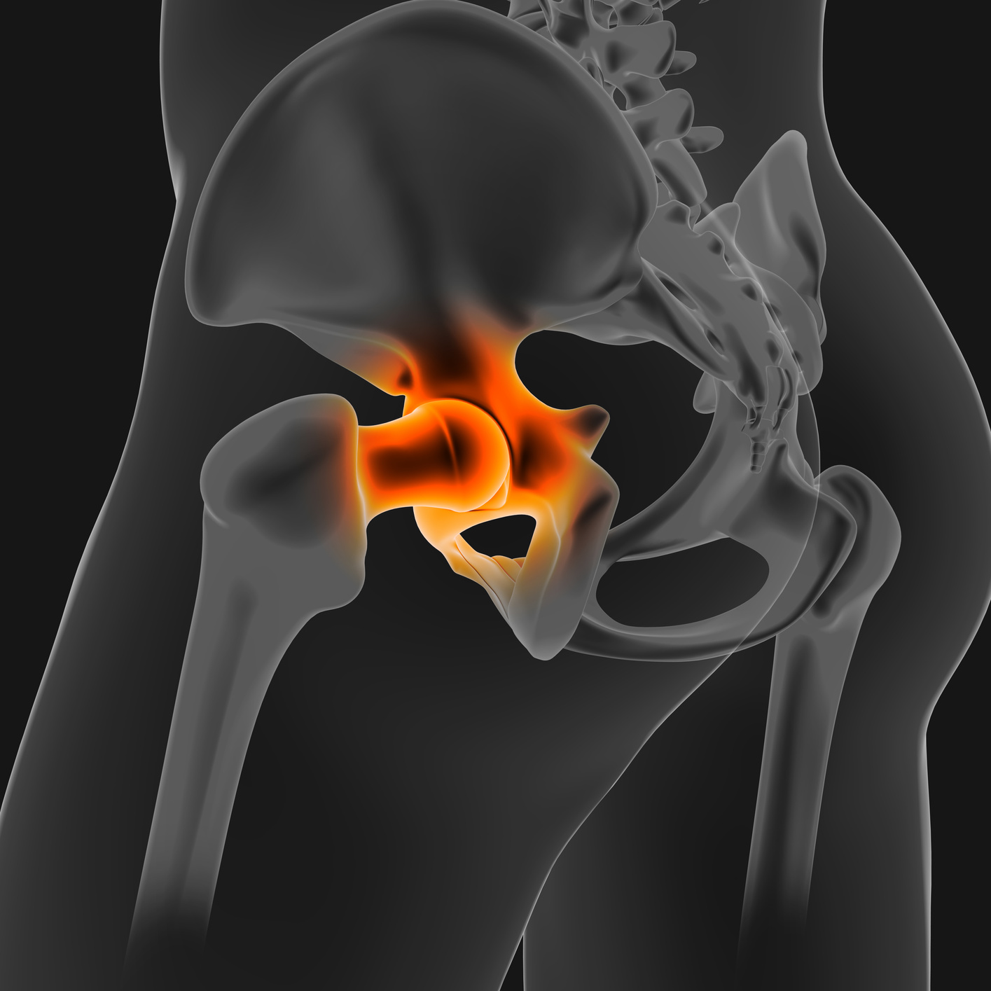 3D_Illustration_hip_joint_painful_skeleton_medical_concept